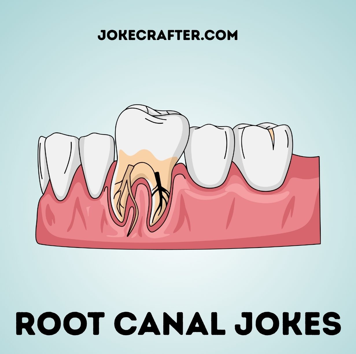 root canal jokes